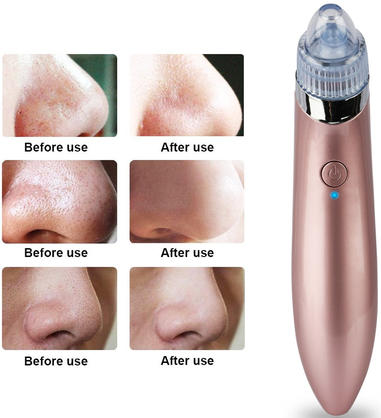 Electric Facial Pore Cleaner Blackhead Vacuum Suction Remover