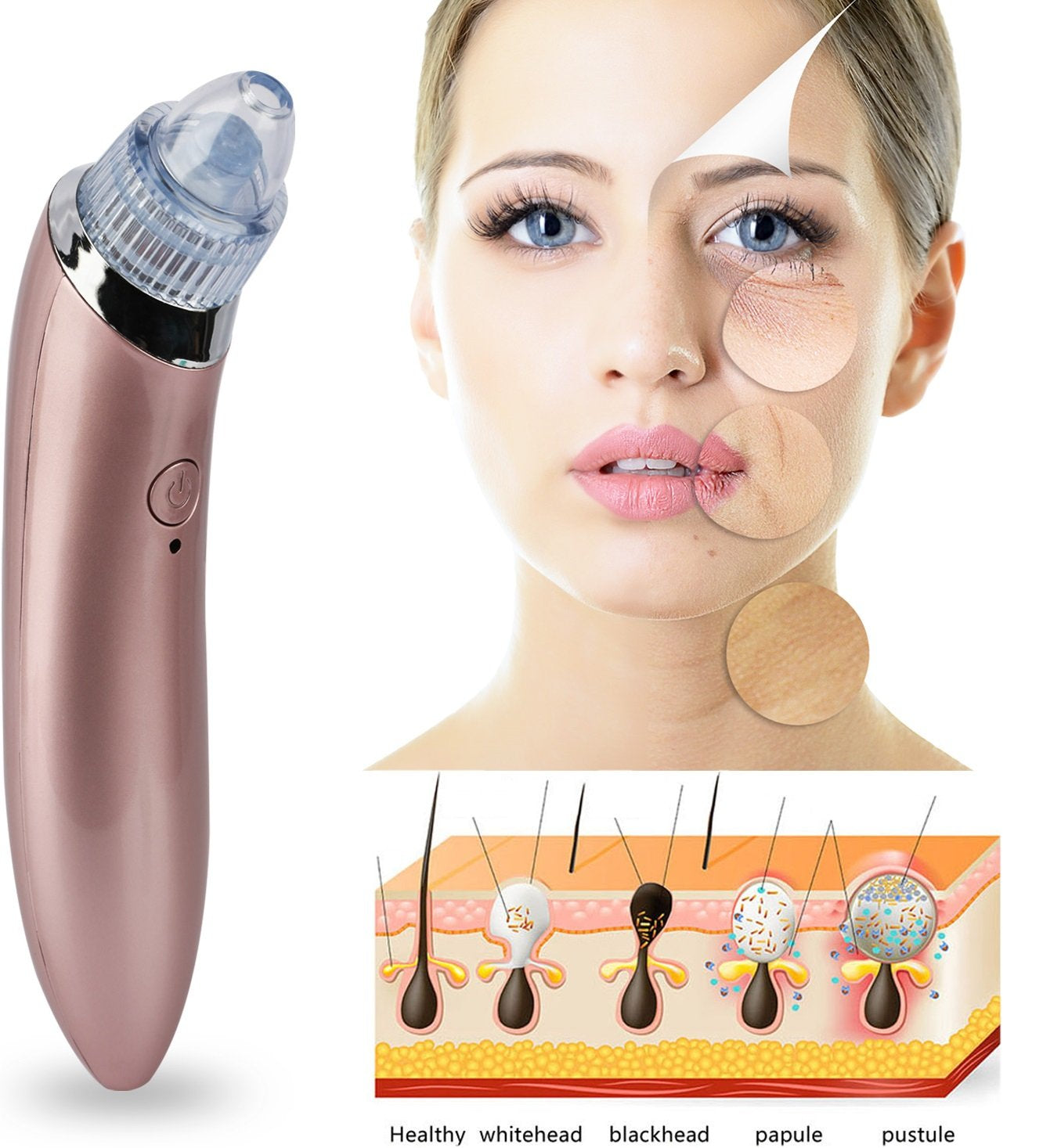 Electric Facial Pore Cleaner Blackhead Vacuum Suction Remover