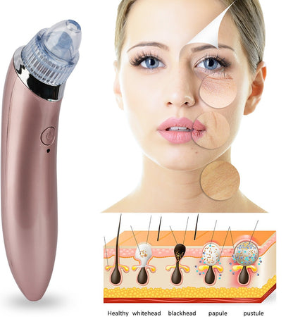 Electric Facial Pore Cleaner Blackhead Vacuum Suction Remover