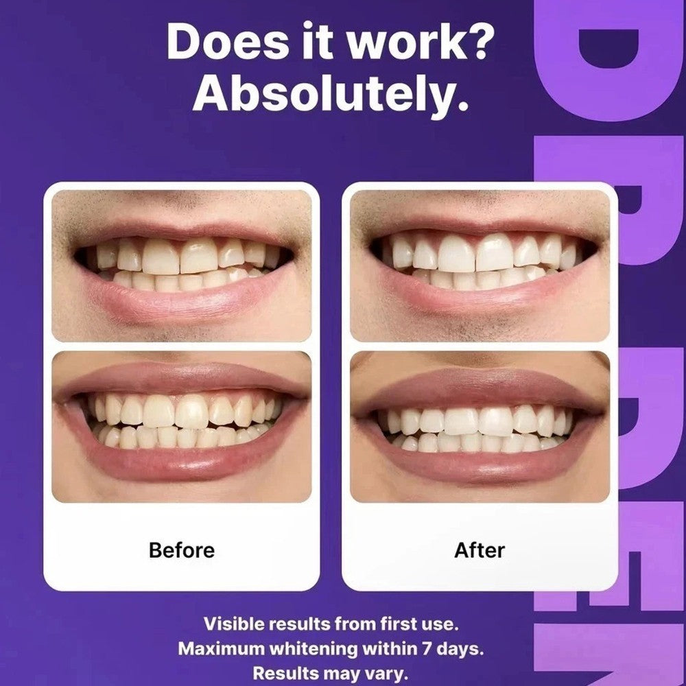 Experience a Brighter Smile with DR.DENT Purple Teeth Whitening Strips - 14 Easy-to-Use, Peroxide Free Strips
