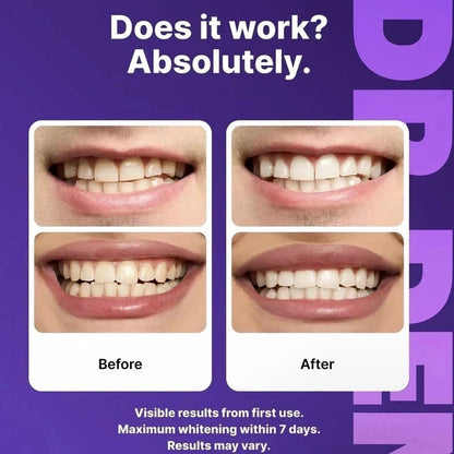 Experience a Brighter Smile with DR.DENT Purple Teeth Whitening Strips - 14 Easy-to-Use, Peroxide Free Strips