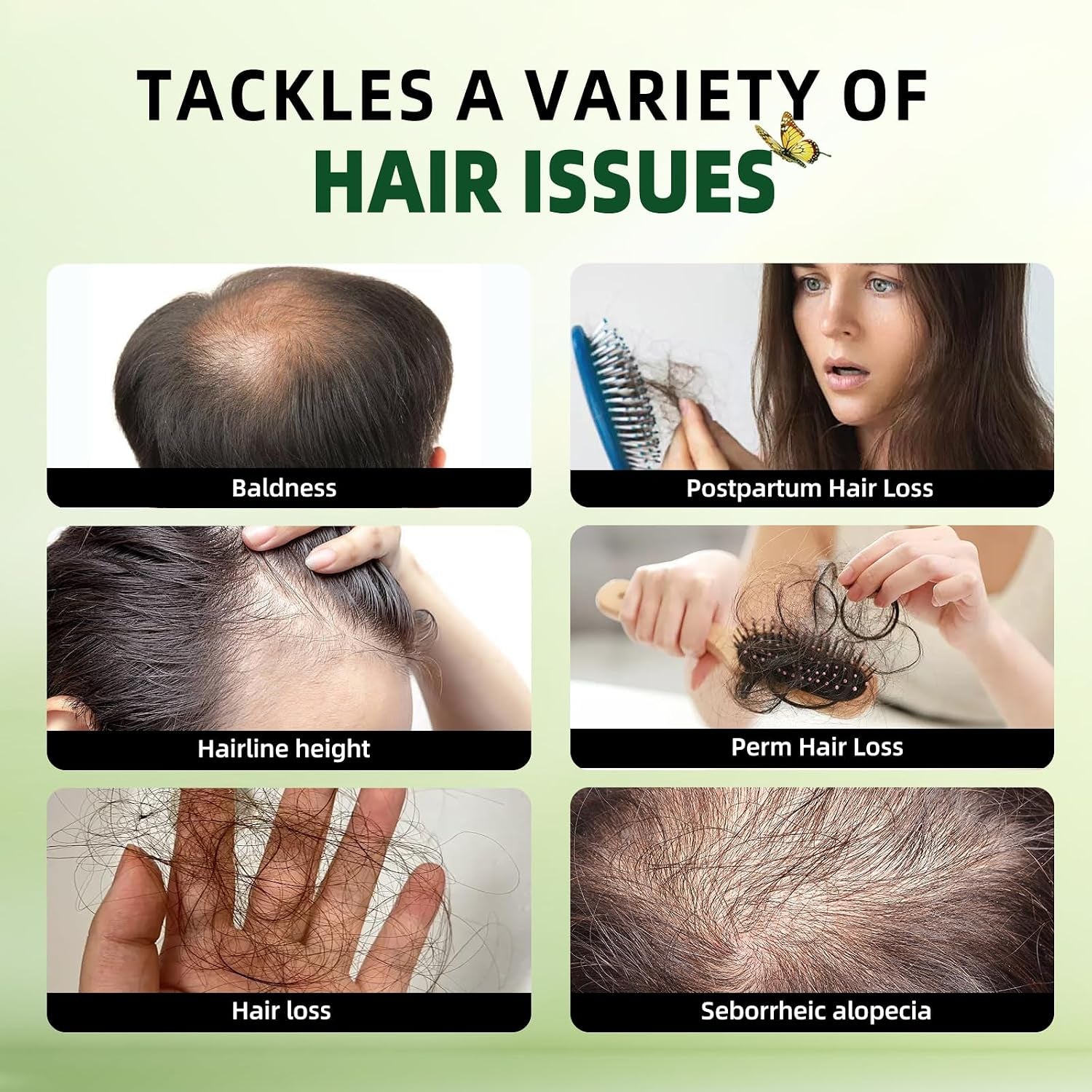 Rosemary Hair Growth Shampoo and Conditioner Set: Thickness & anti Hair Loss Shampoo and Conditioner with Tea Tree Oil Mint Biotin – Strengthening Formula for Men & Women, Thinning & Damaged Hair Care