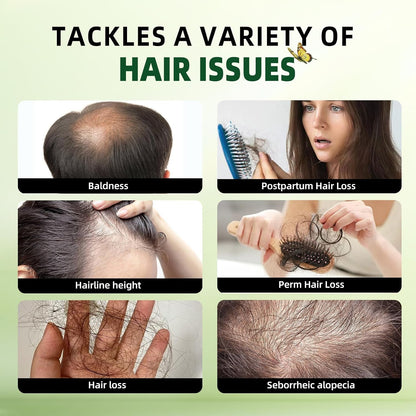 Rosemary Hair Growth Shampoo and Conditioner Set: Thickness & anti Hair Loss Shampoo and Conditioner with Tea Tree Oil Mint Biotin – Strengthening Formula for Men & Women, Thinning & Damaged Hair Care