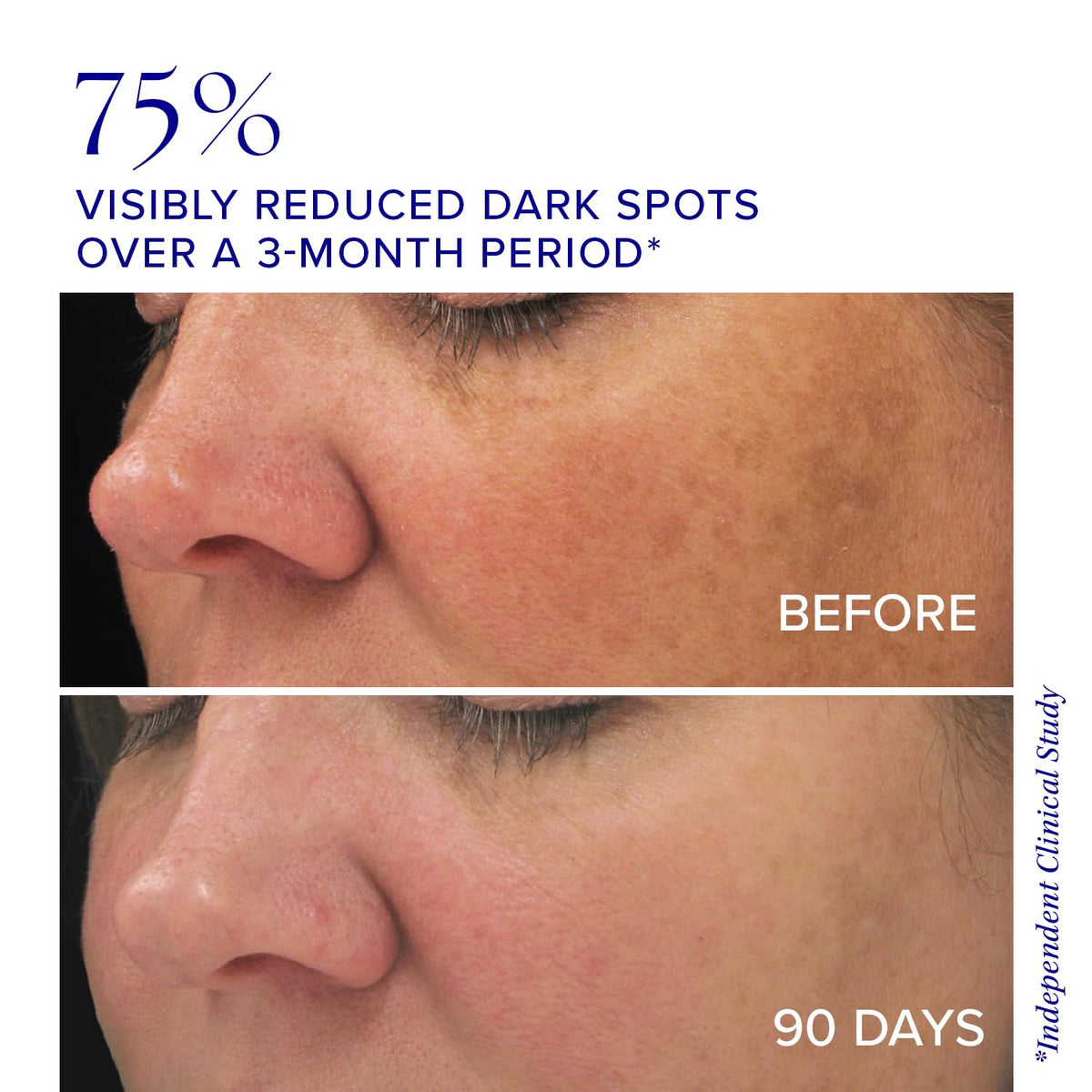 Illuminate Your Skin with iS CLINICAL Brightening Complex - Target Age Spots and Achieve a Radiant Glow